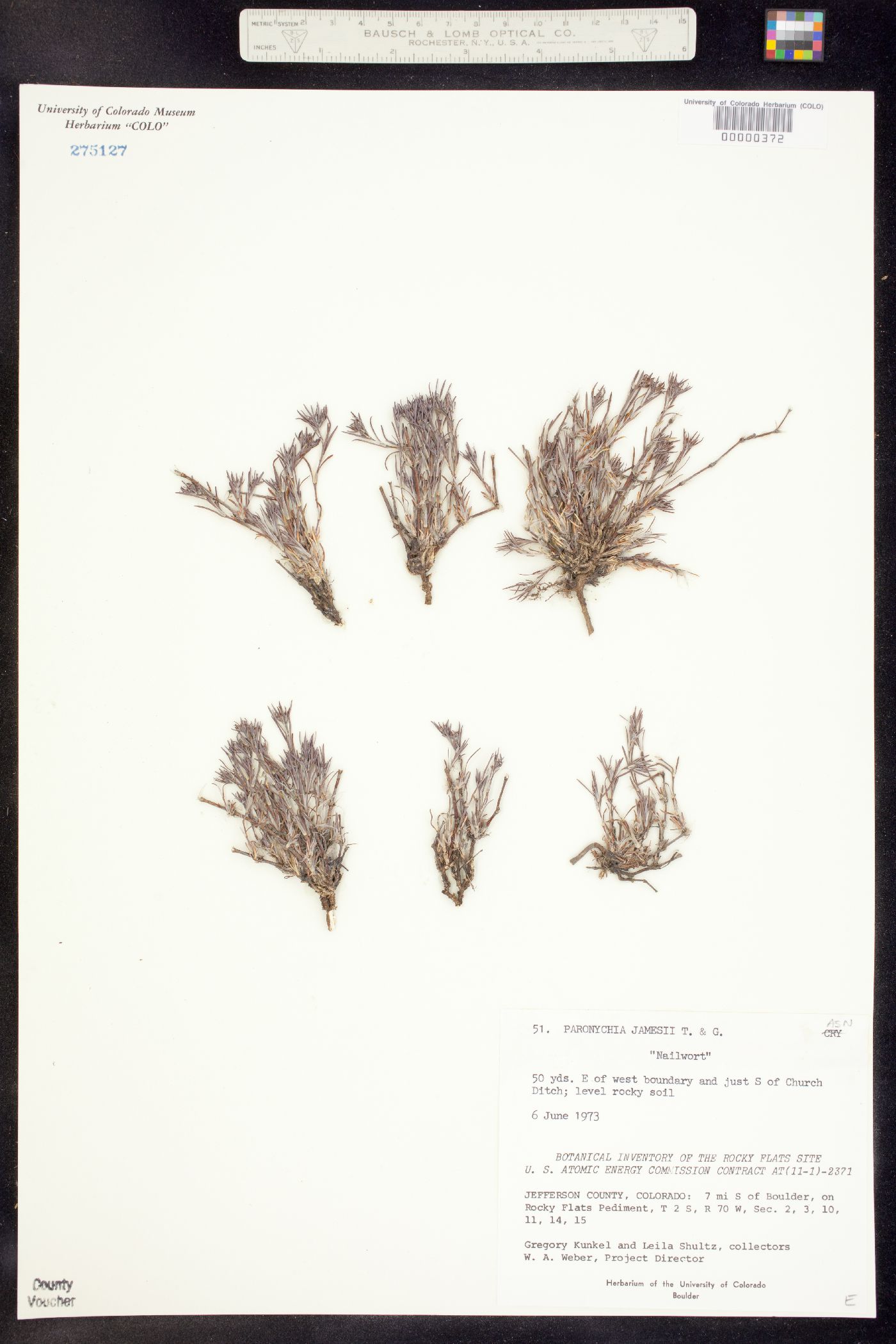 Paronychia image